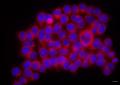 Zdjęcie przedstawia komórki jelitowe inkubowane z pęcherzykami drożdży probiotycznych.